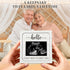 Ivory White Wooden Pregnancy Announcement, Something Beautiful Is Loading, Ultrasound Frame Keepsake Box, Baby Birth