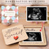 KATINAT Grandparent Reveal Keepsake, Pregnancy Announcement for Grandparents, Baby Announcement Sign, Ultrasound