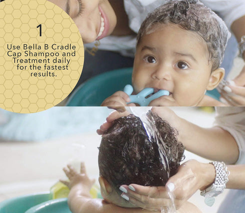 Bella B Cradle Cap Shampoo & Cradle Cap Scalp Treatment | Baby Shampoo and Conditioner for Dry Scalp