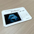 Pregnancy Test Keepsake Box, Pregnancy Announcement for Grandparents, Grandparents Baby Announcement Ideas Card