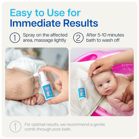 NAVEH PHARMA Cradle Cap Cleanser for Baby & Kids | 100% Natural Treatment, Spray & Wash, 1 FL OZ