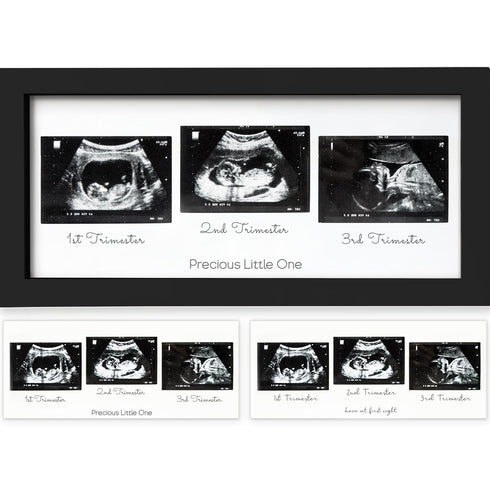 KeaBabies Baby Sonogram Picture Frames - Trio Ultrasound Picture Frames, First Time