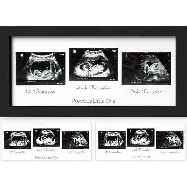 KeaBabies Baby Sonogram Picture Frames - Trio Ultrasound Picture Frames, First Time