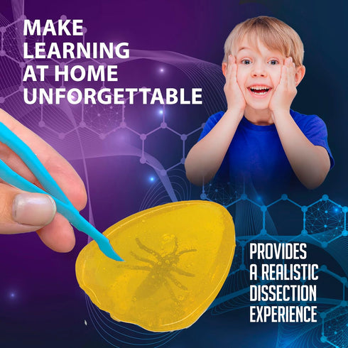 5 Discover-It Dissection Kit for Kids, Synthetic Amber Science Lab Kit to Learn About Insects, Science Toys for Kids