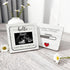 Ivory White Wooden Pregnancy Announcement, Something Beautiful Is Loading, Ultrasound Frame Keepsake Box, Baby Birth